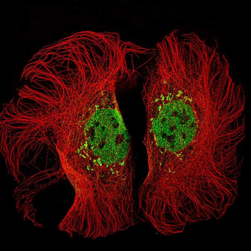 KMT2D Antibody (CL5346) - BSA Free Immunocytochemistry/ Immunofluorescence: KMT2D Antibody (CL5346) - BSA Free [NBP2-61416]