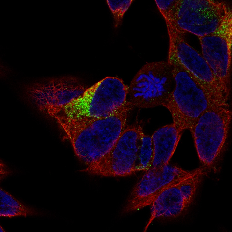 MAP2 Antibody (CL5420) - BSA Free Immunocytochemistry/ Immunofluorescence: MAP2 Antibody (CL5420) [NBP3-52490]