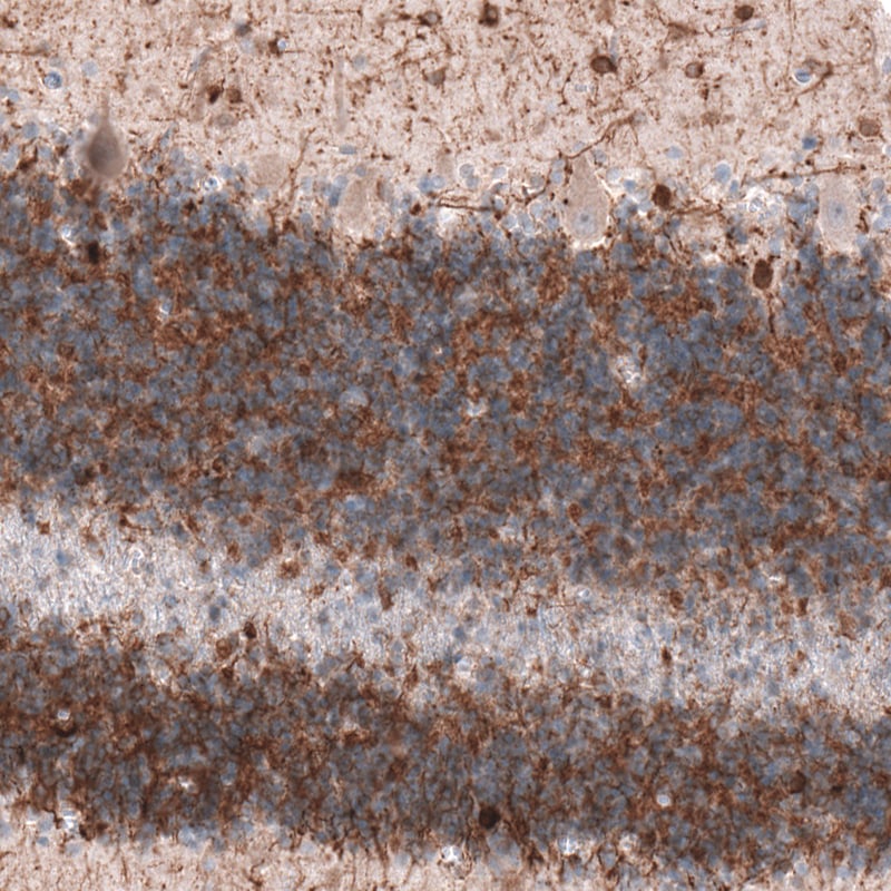 MAP2 Antibody (CL5420) - BSA Free Immunohistochemistry: MAP2 Antibody (CL5420) [NBP3-52490]