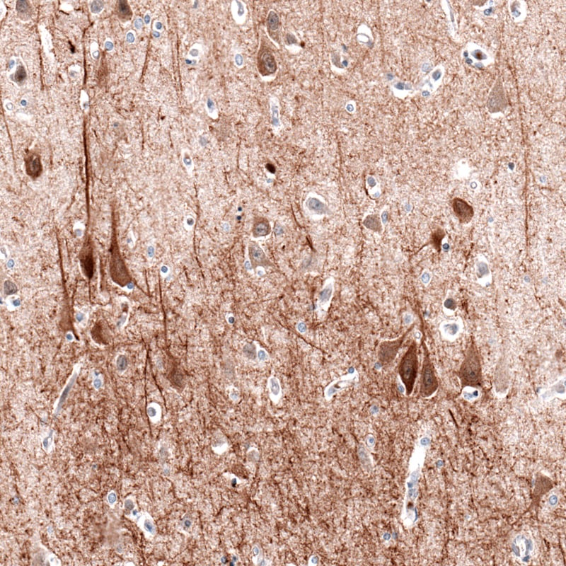 MAP2 Antibody (CL5420) - BSA Free Immunohistochemistry: MAP2 Antibody (CL5420) [NBP3-52490]