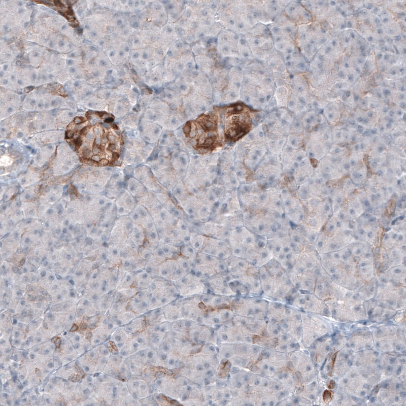 MAP2 Antibody (CL5420) - BSA Free Immunohistochemistry: MAP2 Antibody (CL5420) [NBP3-52490]