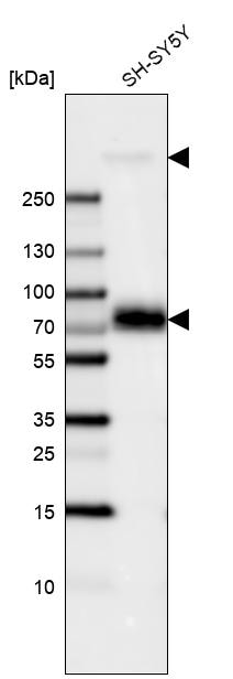 MAP2 Antibody (CL5420) - BSA Free Western Blot: MAP2 Antibody (CL5420) [NBP3-52490]