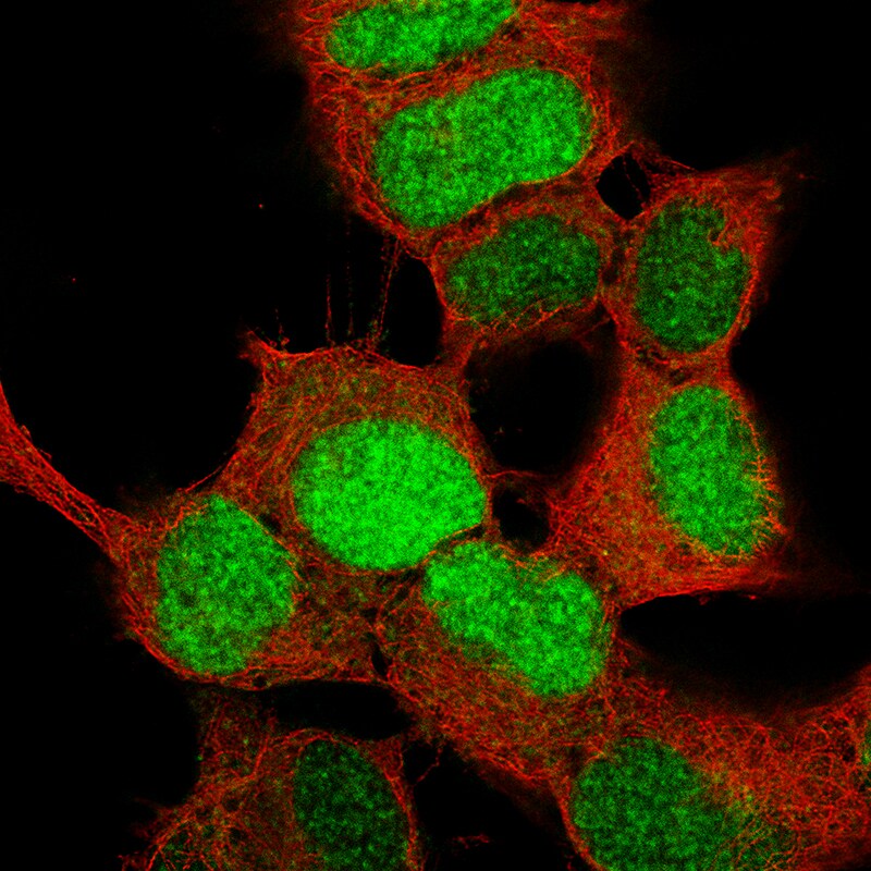 SOX4 Antibody (CL5634) - BSA Free Immunocytochemistry/ Immunofluorescence: SOX4 Antibody (CL5634) [NBP2-61420]