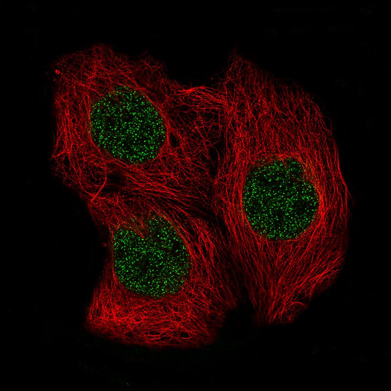 SOX6 Antibody (CL5690) - BSA Free Immunocytochemistry/ Immunofluorescence: SOX6 Antibody (CL5690) [NBP2-61423] -