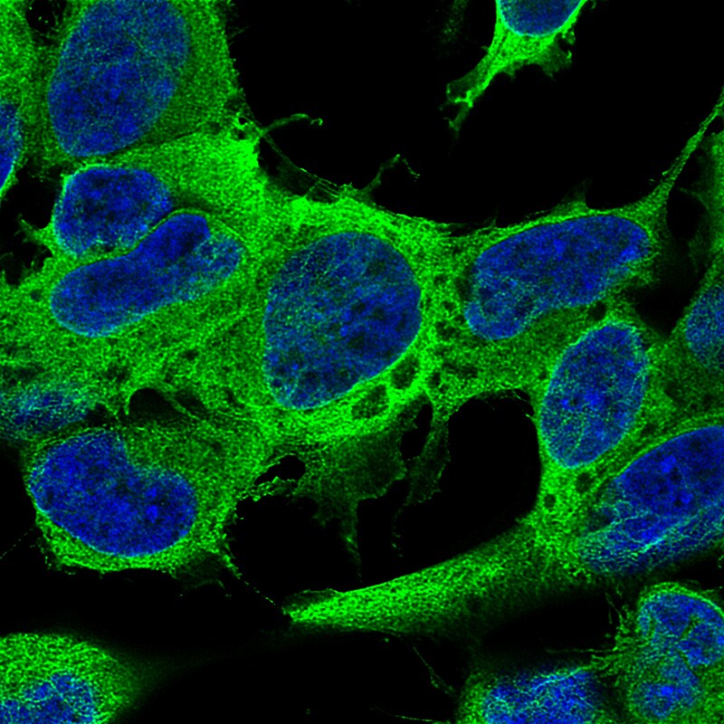 beta-III Tubulin Antibody (CL5813) - BSA Free Immunocytochemistry/ Immunofluorescence: beta-III Tubulin Antibody (CL5813) [NBP3-52481]