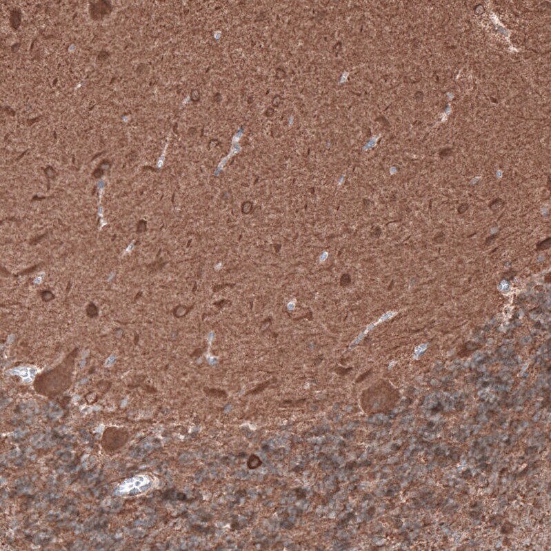 beta-III Tubulin Antibody (CL5813) - BSA Free Immunohistochemistry: beta-III Tubulin Antibody (CL5813) [NBP3-52481]