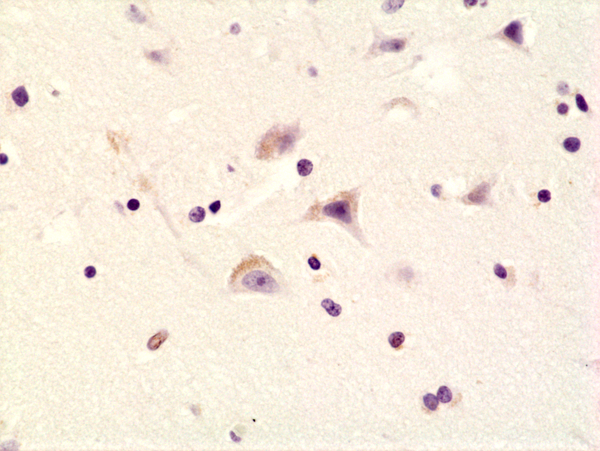GluR1 [p Ser845] Antibody (RM296)
