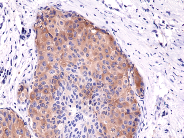 Acetyl-CoA Carboxylase alpha/ACACA [p Ser79] Antibody (RM270)