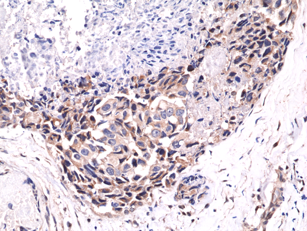 AKT1 [p Ser473] Antibody (RM251)