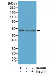 AKT1 [p Ser473] Antibody (RM251)