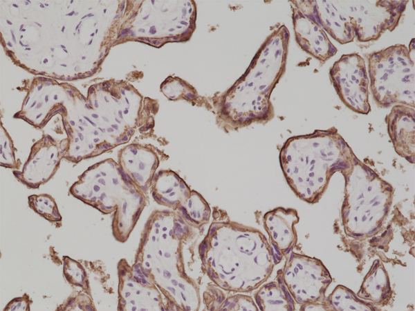 Alkaline Phosphatase/ALPP Antibody (RM317)