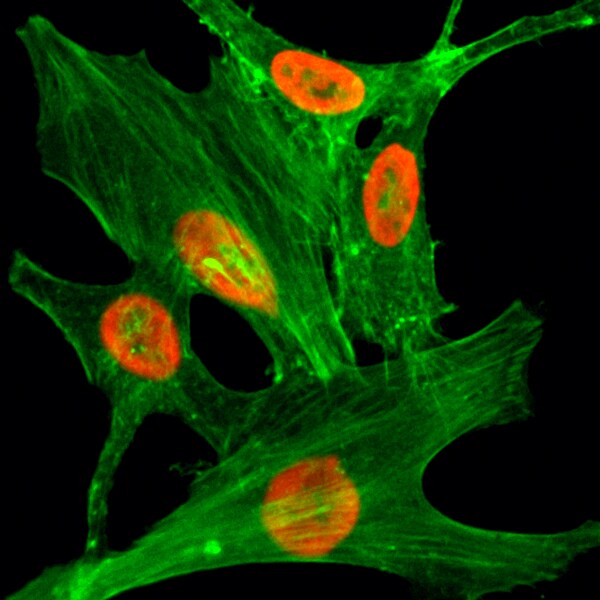 Histone H2A.Z [ac Lys4] Antibody (RM221)