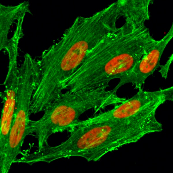 Histone H2A.Z [ac Lys7] Antibody (RM222)