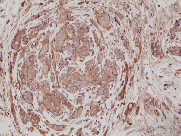 Alpha Actinin 4 Antibody (RM287)