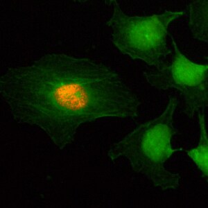 Histone H2AE [p Ser1] Antibody (RM216)