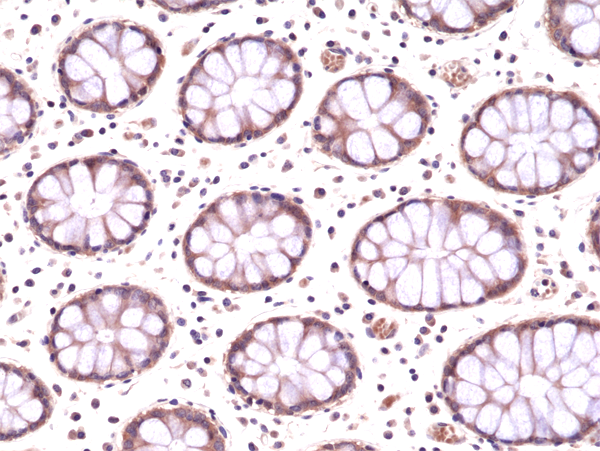 AMPK alpha 1 Antibody (RM301)