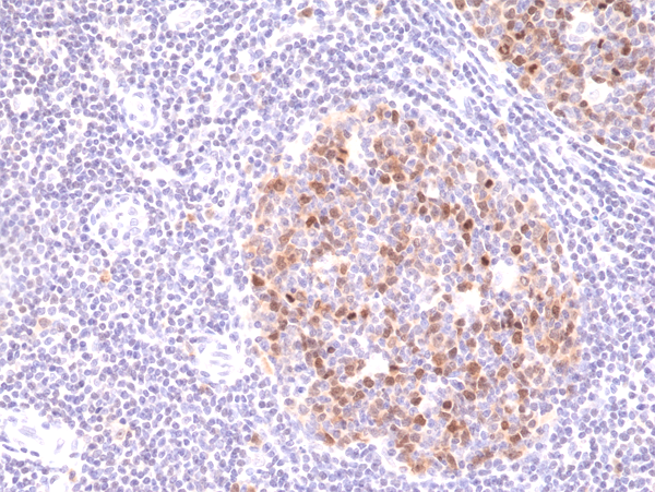 Aurora B Antibody (RM278)