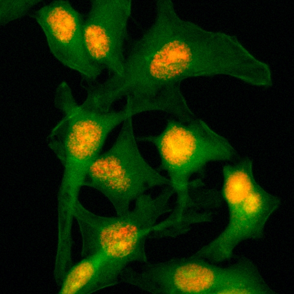 Histone H2B Antibody (RM230)
