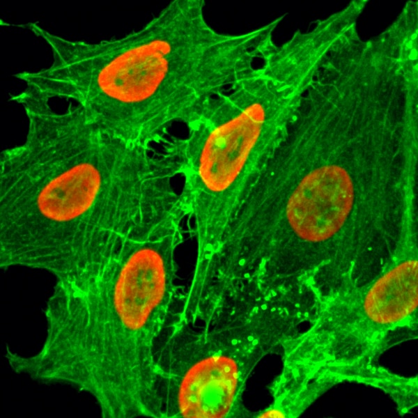 Histone H2B type 1B [ac Lys20] Antibody (RM235)