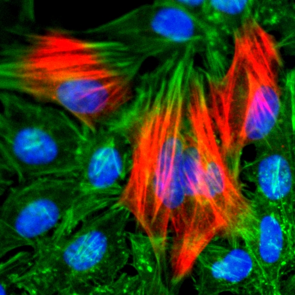 Calponin 1 Antibody (RM262)
