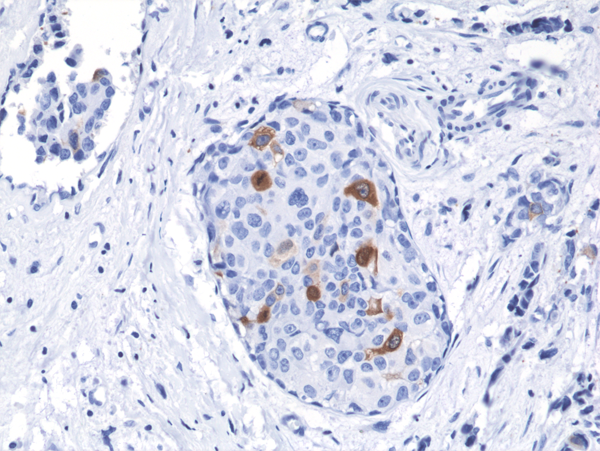 Cyclin B1 Antibody (RM281)
