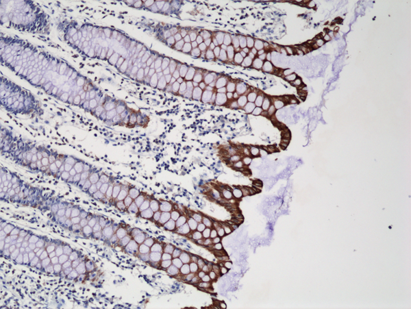 Cytokeratin 20 Antibody (RM283)