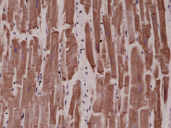 Desmin Antibody (RM234)