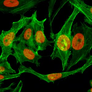 Histone H3 [Monomethyl Lys9] Antibody (RM150)