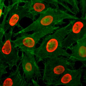 Histone H3 [ac Lys9] Antibody (RM161)