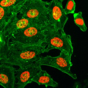 Histone H3 [ac Lys18] Antibody (RM166)