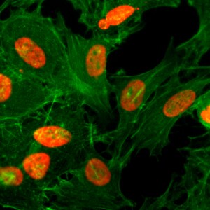 Histone H3 [ac Lys36] Antibody (RM154)