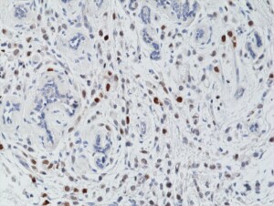 Histone H3 [p Thr3] Antibody (RM159)