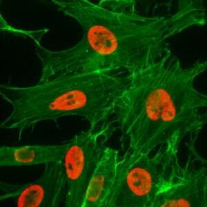 Histone H3 [ac Lys27] Antibody (RM172)