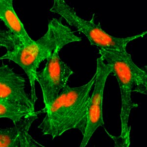 Histone H4 [ac Lys12] Antibody (RM202)