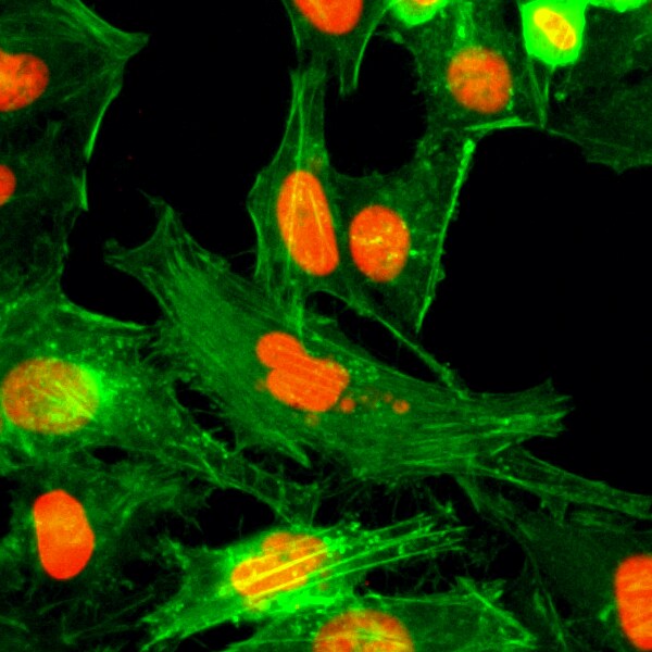 Histone H4 [Monomethyl Arg3] Antibody (RM195)