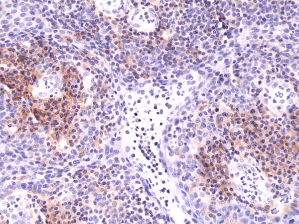 Integrin alpha 4/CD49d Antibody (RM268)