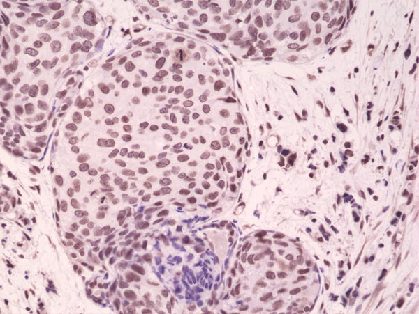 p38 alpha [p Tyr182, p Thr180] Antibody (RM243)