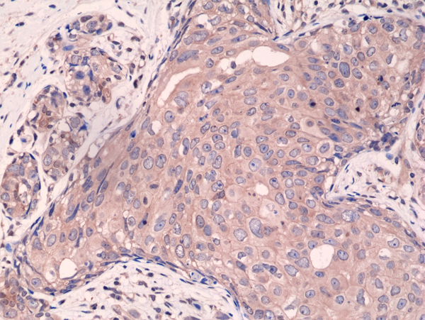 Smad4 Antibody (RM277)