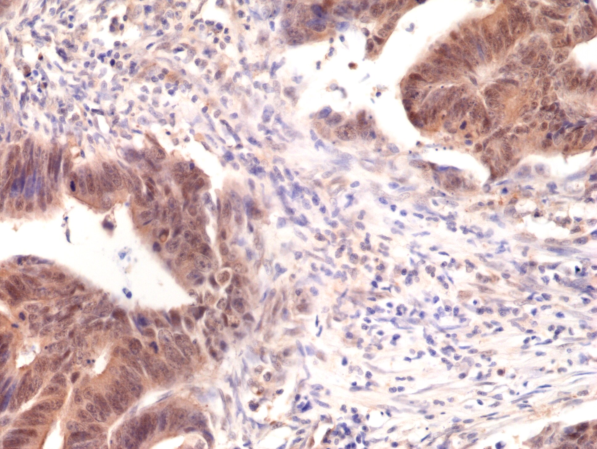 Smad4 Antibody (RM277)