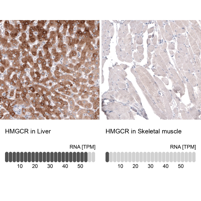 HMG-CoA Reductase/HMGCR Antibody (CL0259) - BSA Free Immunohistochemistry: HMG-CoA Reductase/HMGCR Antibody (CL0259) [NBP3-52446]