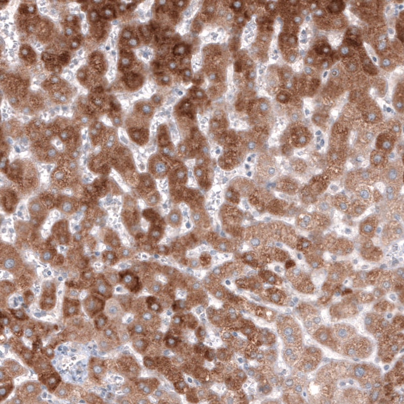 HMG-CoA Reductase/HMGCR Antibody (CL0259) - BSA Free Immunohistochemistry: HMG-CoA Reductase/HMGCR Antibody (CL0259) [NBP3-52446]