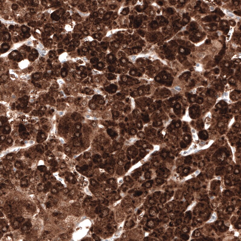 HMG-CoA Reductase/HMGCR Antibody (CL0259) - BSA Free Immunohistochemistry: HMG-CoA Reductase/HMGCR Antibody (CL0259) [NBP3-52446]
