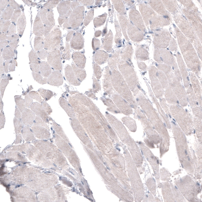 HMG-CoA Reductase/HMGCR Antibody (CL0259) - BSA Free Immunohistochemistry: HMG-CoA Reductase/HMGCR Antibody (CL0259) [NBP3-52446]