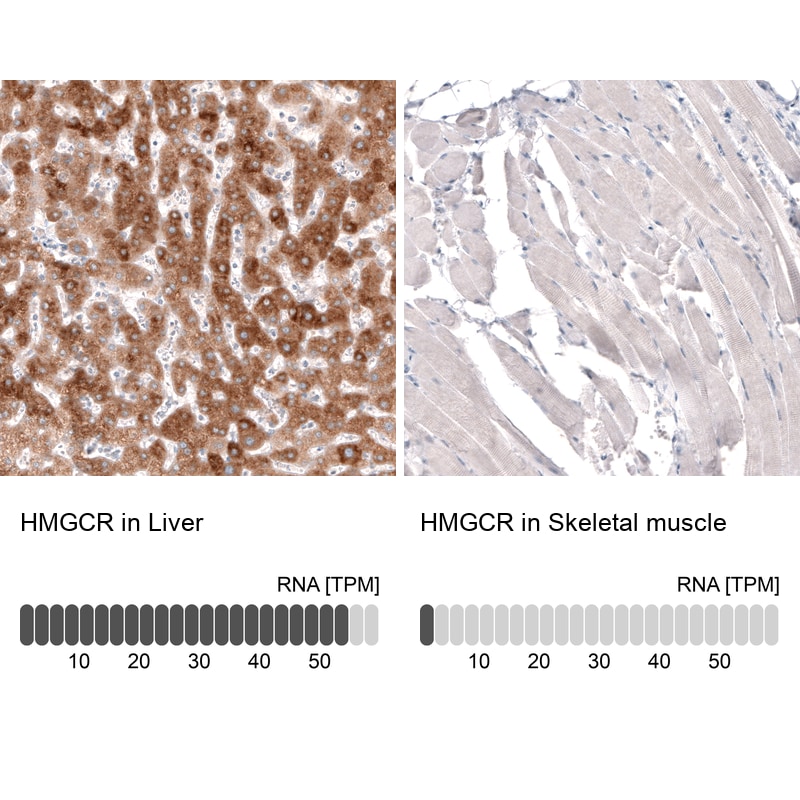 HMG-CoA Reductase/HMGCR Antibody (CL0260) - BSA Free Immunohistochemistry: HMG-CoA Reductase/HMGCR Antibody (CL0260) [NBP3-52447]
