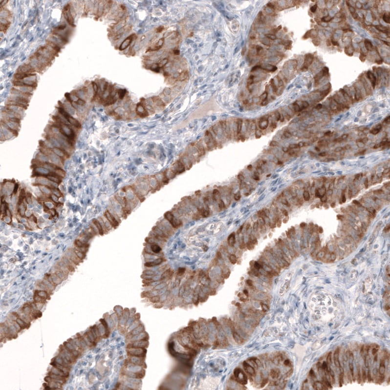 HMG-CoA Reductase/HMGCR Antibody (CL0260) - BSA Free Immunohistochemistry: HMG-CoA Reductase/HMGCR Antibody (CL0260) [NBP3-52447]