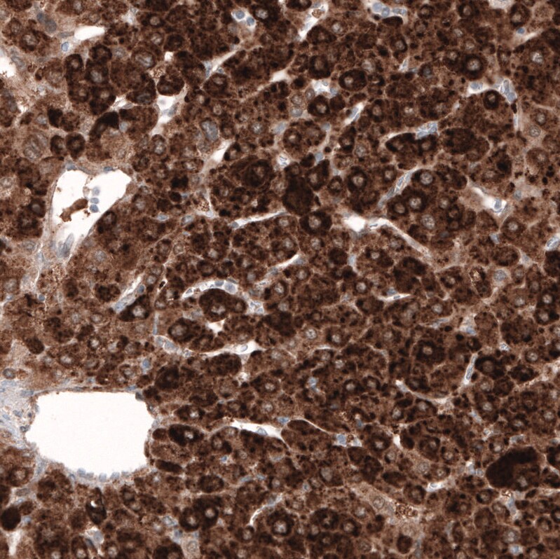 HMG-CoA Reductase/HMGCR Antibody (CL0260) - BSA Free Immunohistochemistry: HMG-CoA Reductase/HMGCR Antibody (CL0260) [NBP3-52447]