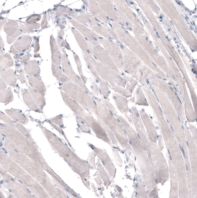 HMG-CoA Reductase/HMGCR Antibody (CL0260) - BSA Free Immunohistochemistry: HMG-CoA Reductase/HMGCR Antibody (CL0260) [NBP3-52447]