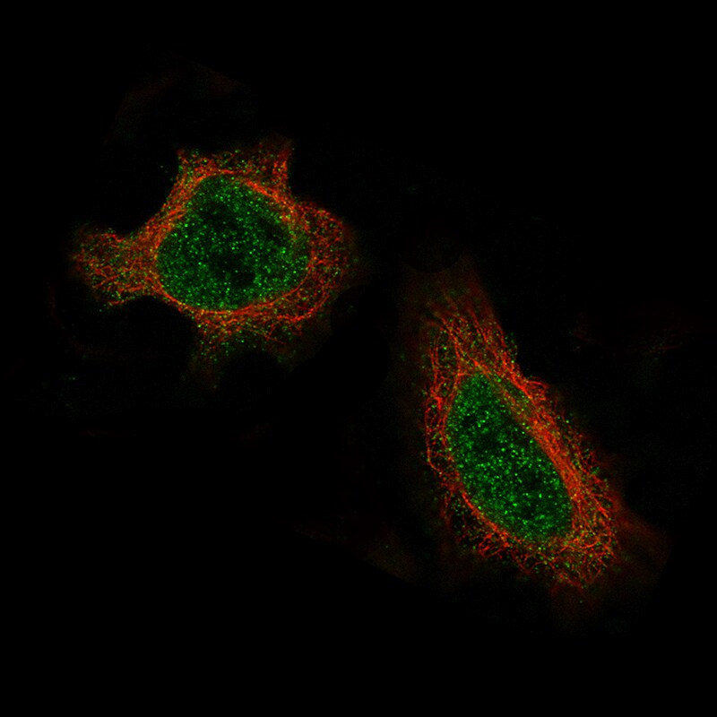 Daxx Antibody (CL3580) - BSA Free Immunocytochemistry/ Immunofluorescence: Daxx Antibody (CL3580) [NBP2-61622]