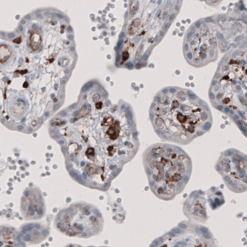 FCRN/FCGRT Antibody (CL3640) - BSA Free Immunohistochemistry-Paraffin: FCRN/FCGRT Antibody (CL3640) [NBP2-61627]