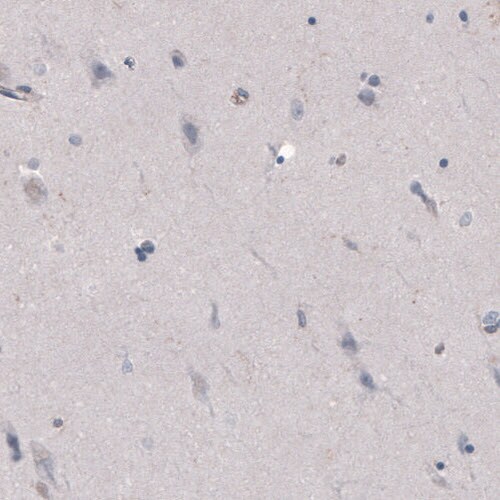 FCRN/FCGRT Antibody (CL3640) - BSA Free Immunohistochemistry-Paraffin: FCRN/FCGRT Antibody (CL3640) [NBP2-61627]